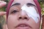 وصول ممرضة شبرا إلى جلسة محاكمة المتهمين بفقء عينها